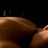 Hong Qi Acupuncture