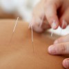 Acupuncture & Alternatives For Health